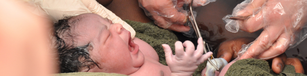 de navelstreng doorknippen bij een bevalling